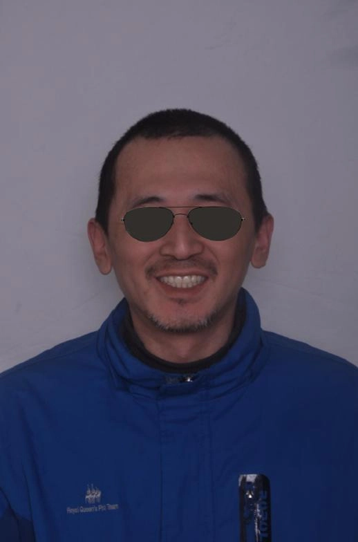 BPS全口假牙治療