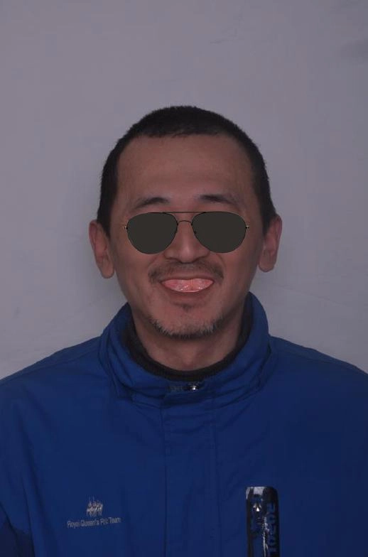 BPS全口假牙治療