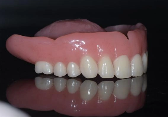 BPS全口假牙治療