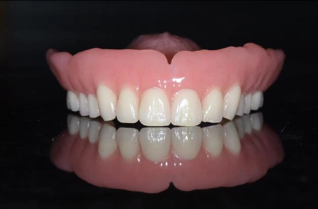 BPS全口假牙治療