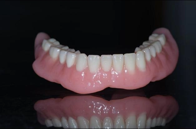 BPS全口假牙治療