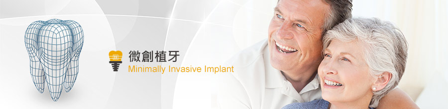 人工植牙(導航技術)