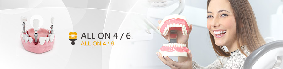 All-on-4 一日全口重建