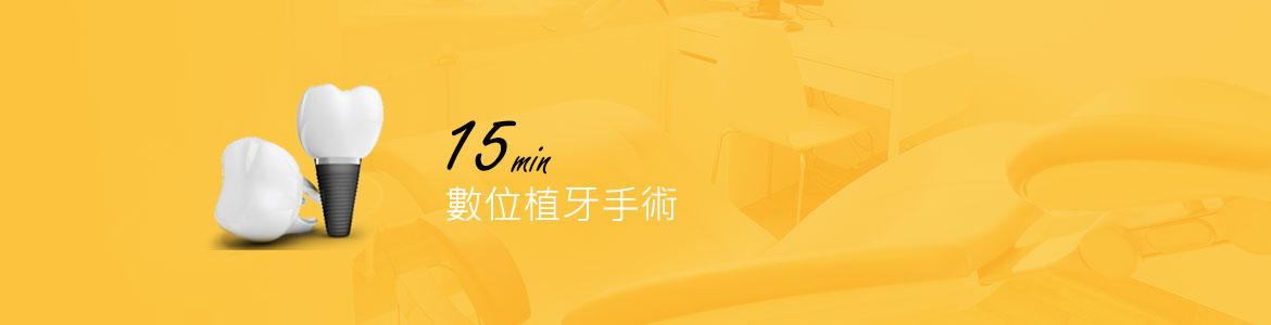 人工植牙(導航技術)