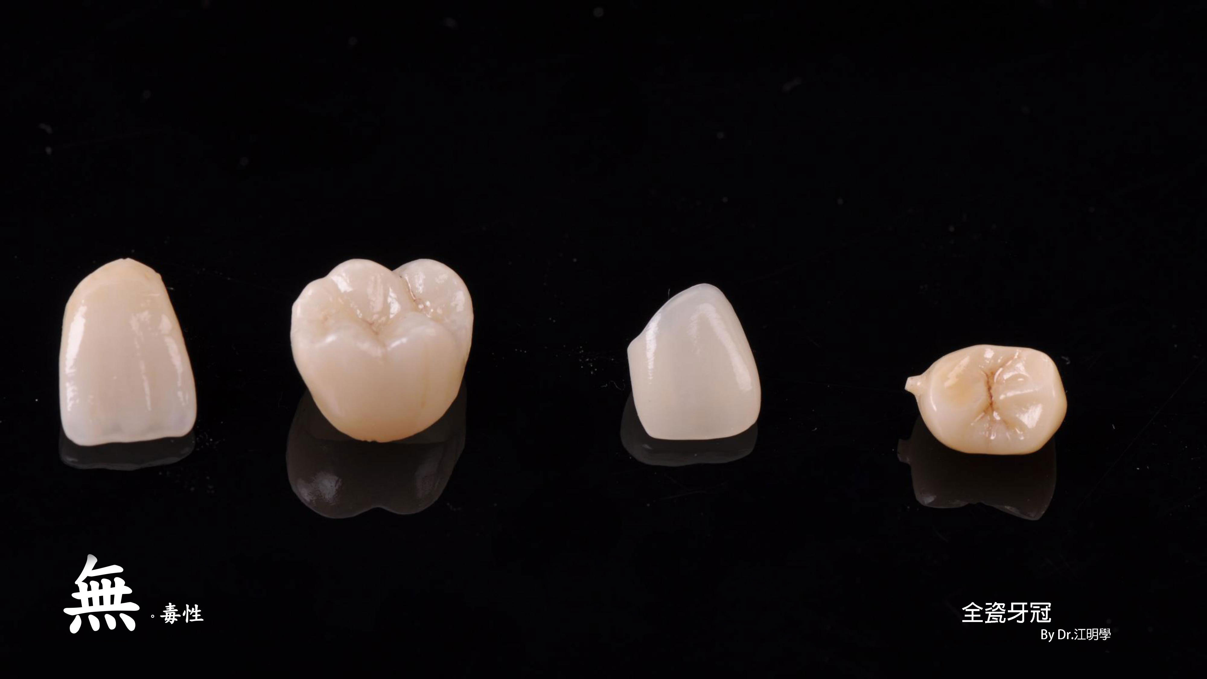 全瓷牙冠 全瓷牙冠