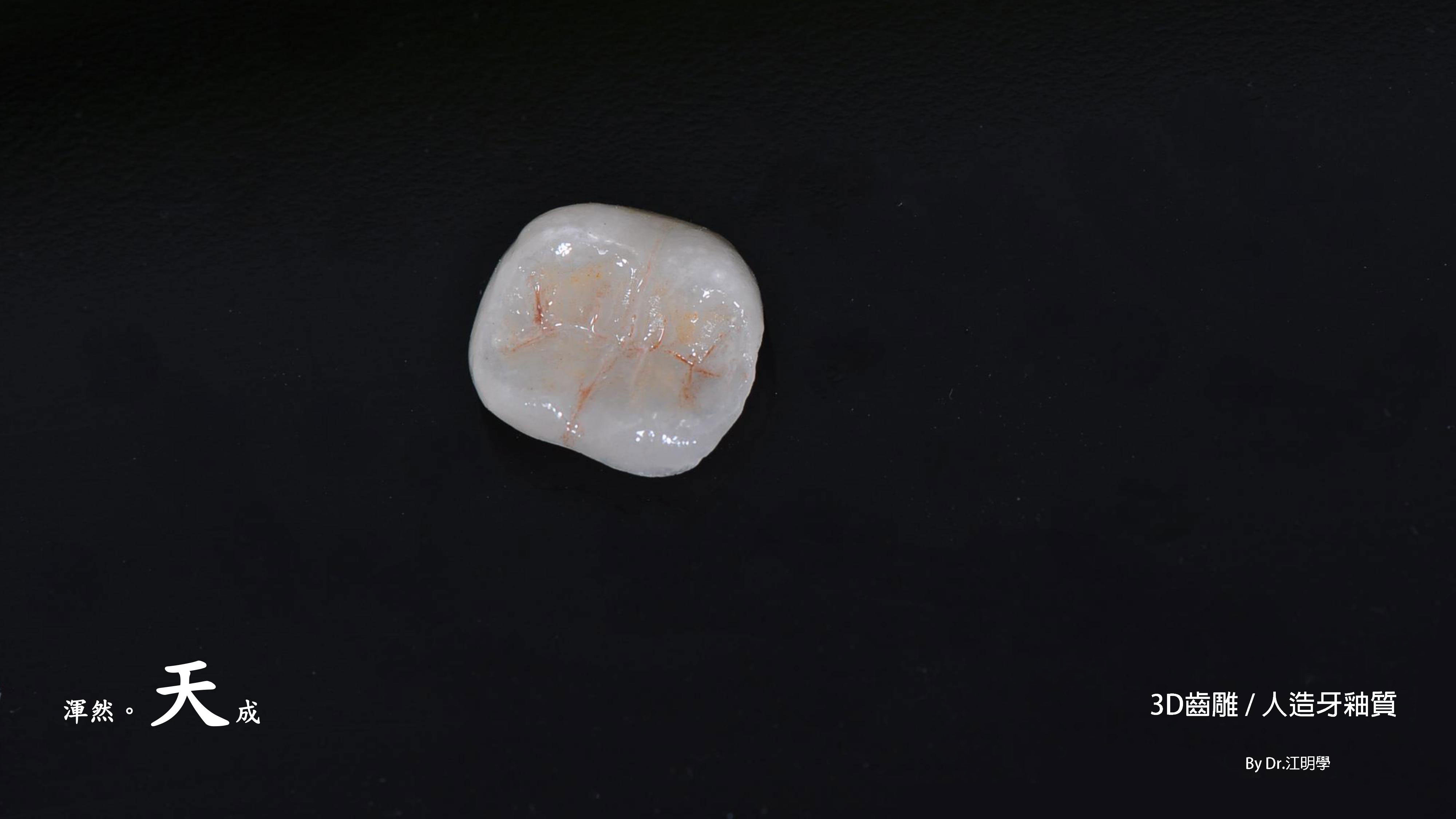 全瓷牙冠 全瓷牙冠