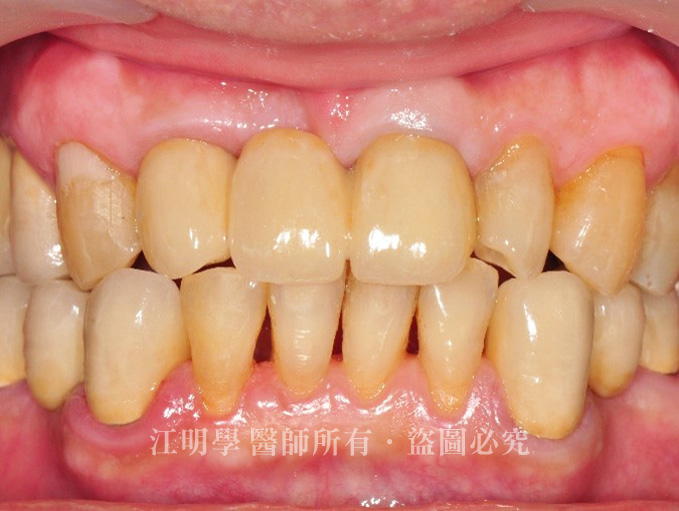 3D導航 DSD 數位微笑設計